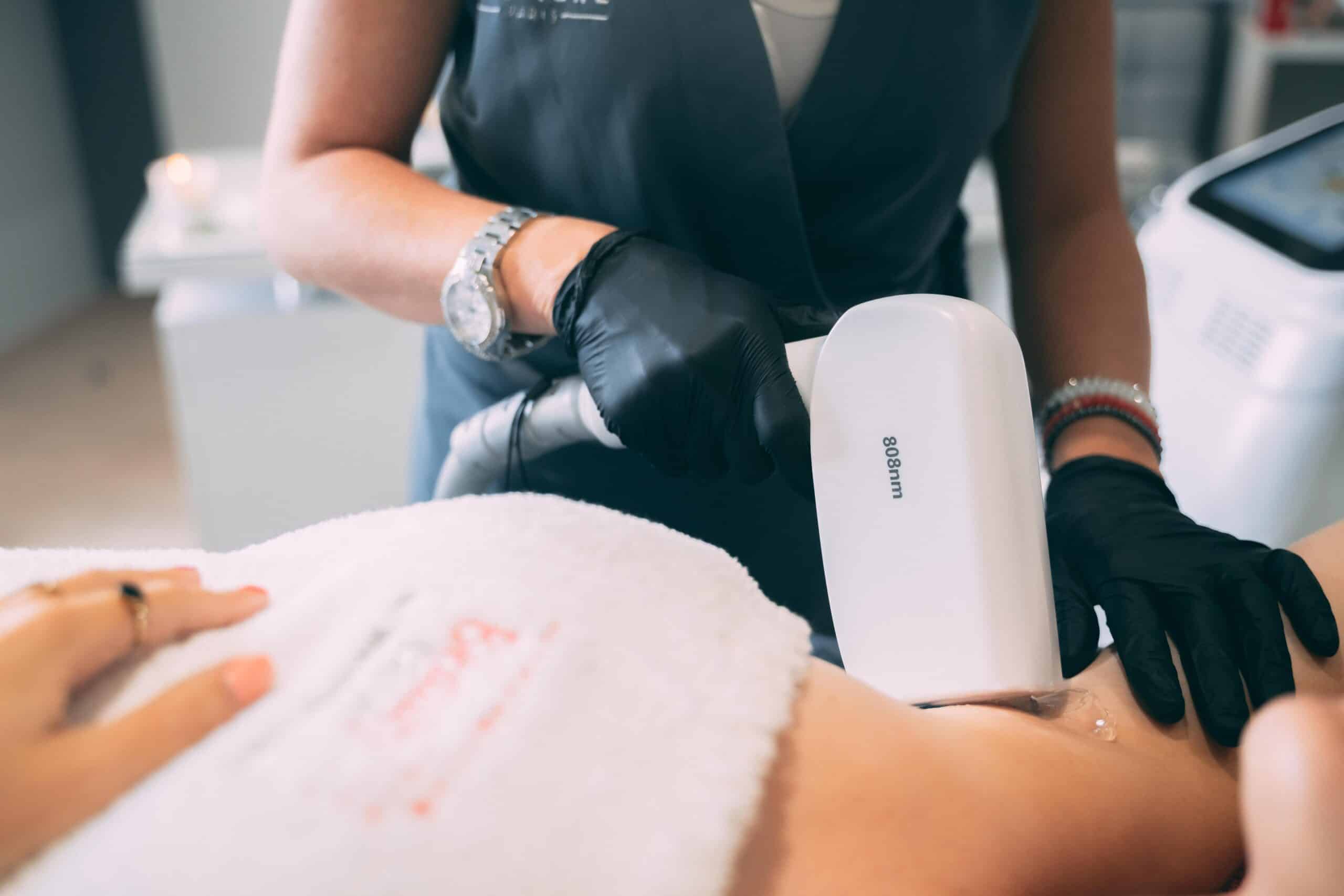 Epilation définitive